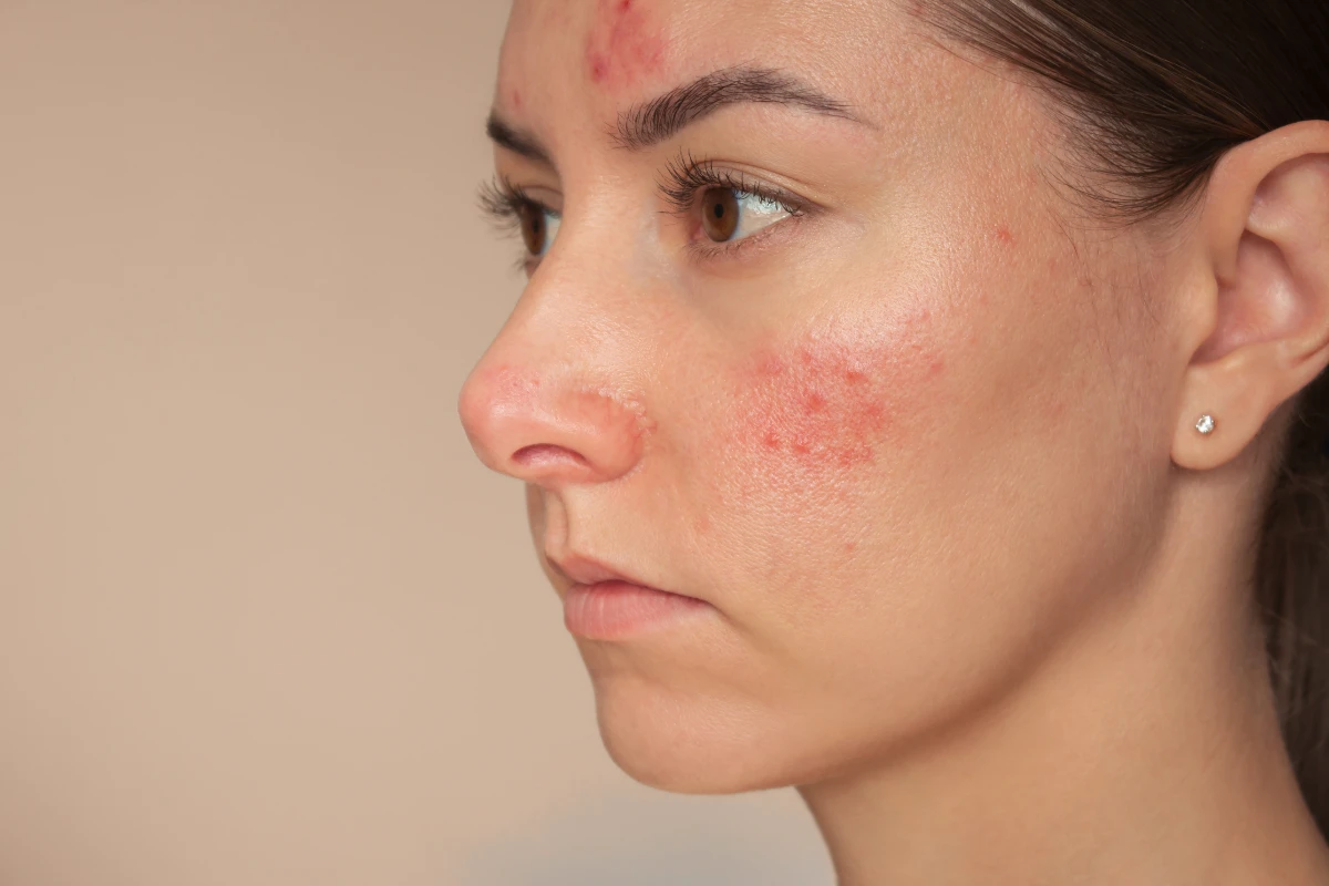 Dermatologia Servicios D3 Medical